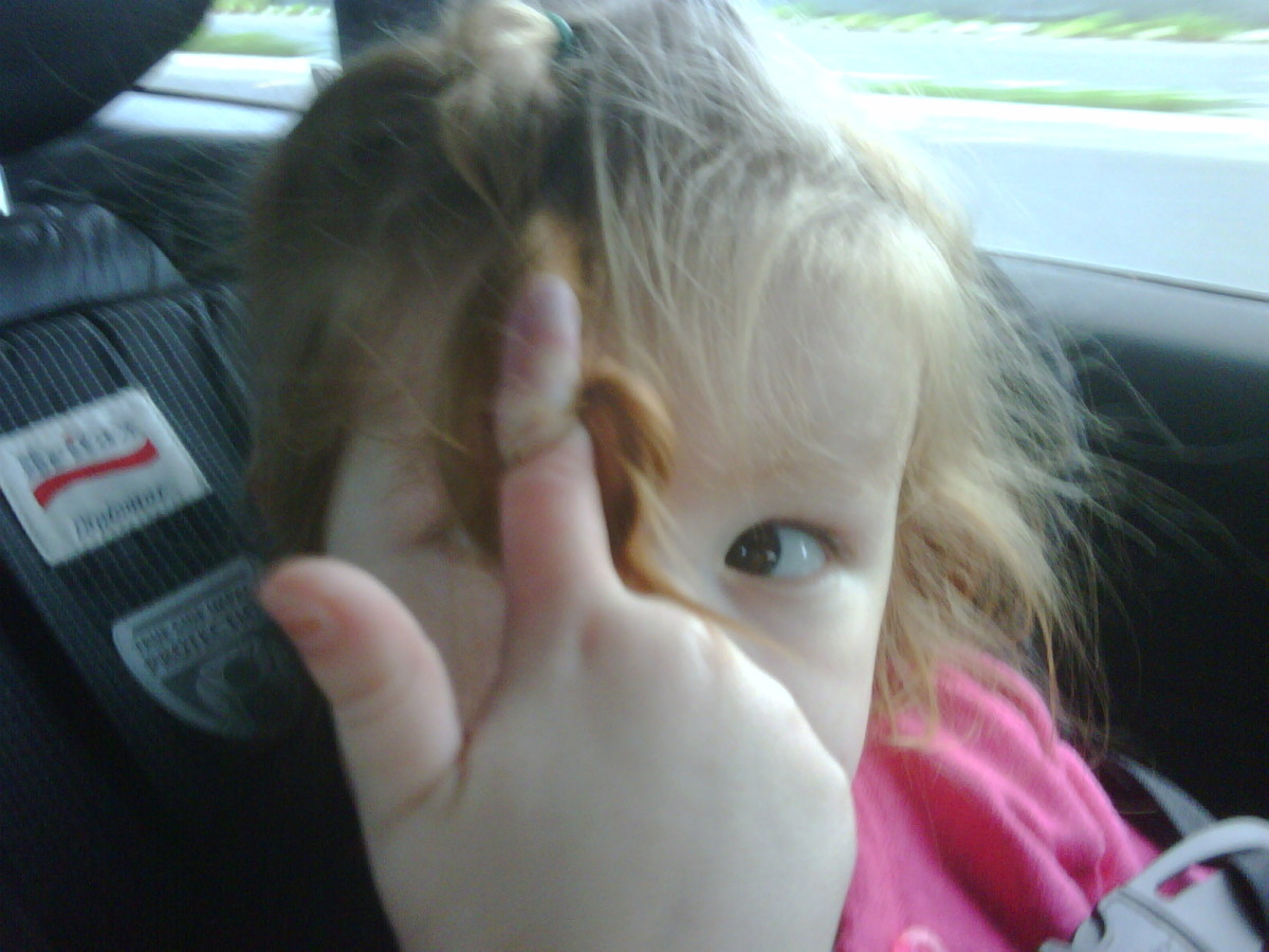 Signs of Trichotillomania in Young Children Look for Bald Spots and Broken Hair from Child