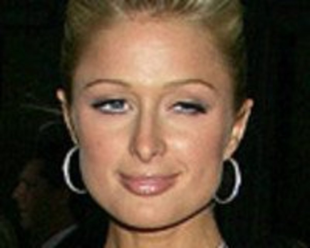 Celebrities with Ptosis