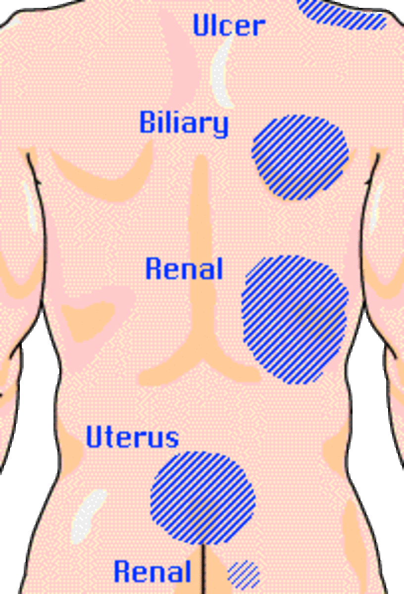 General DoctorPatient Idea about Urological signs and symptoms HubPages