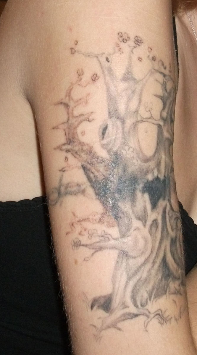 My Experience Lightening and Removing My Tattoo at Home