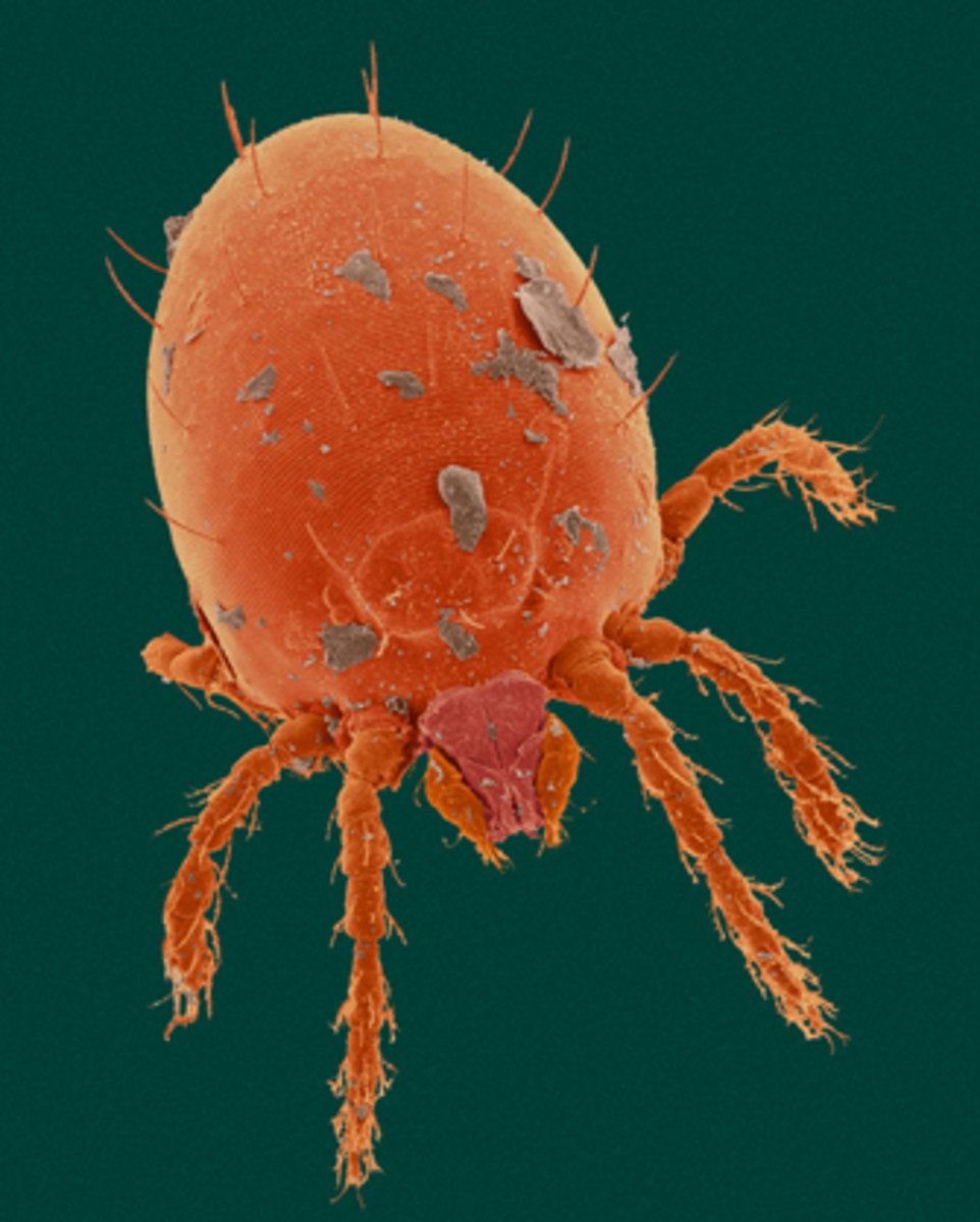 CHIGGERS! Fun, Yet...Kinda Gross, Facts About This Itchy Pest of