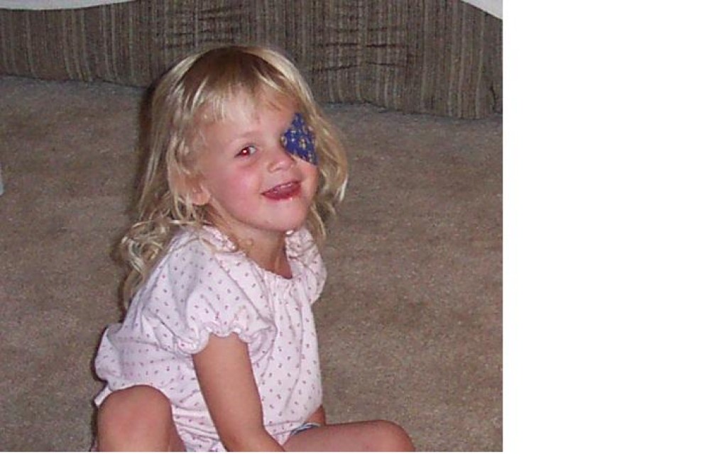 Lazy Eye Surgery in Children a Survival Guide HubPages