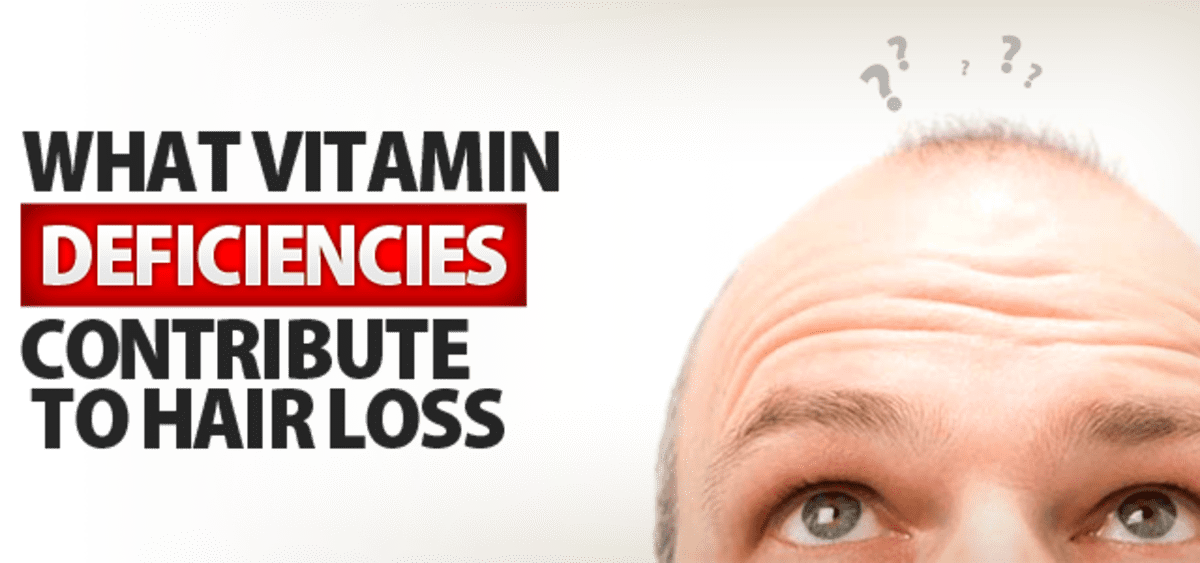 Causes and Treatment for Seborrheic Dermatitis and Related Hair Loss