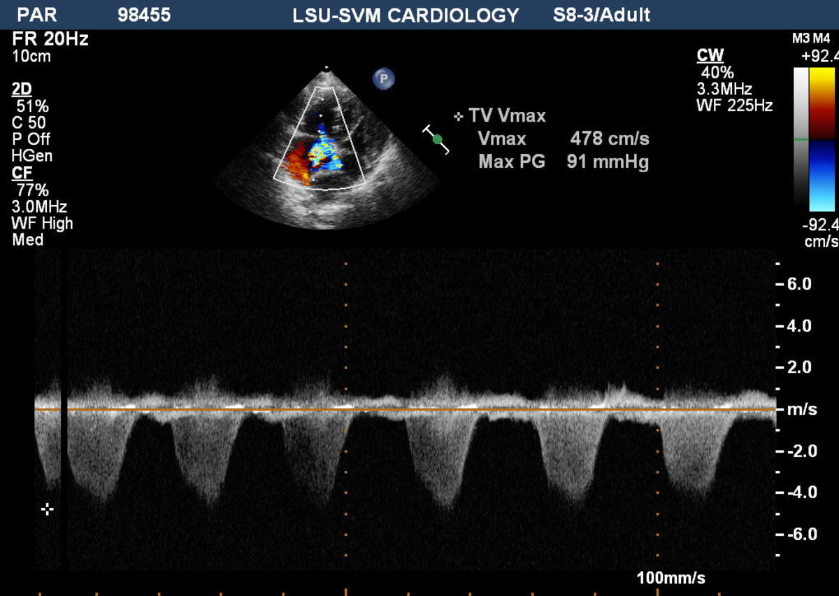 What To Expect From An Echocardiogram HubPages