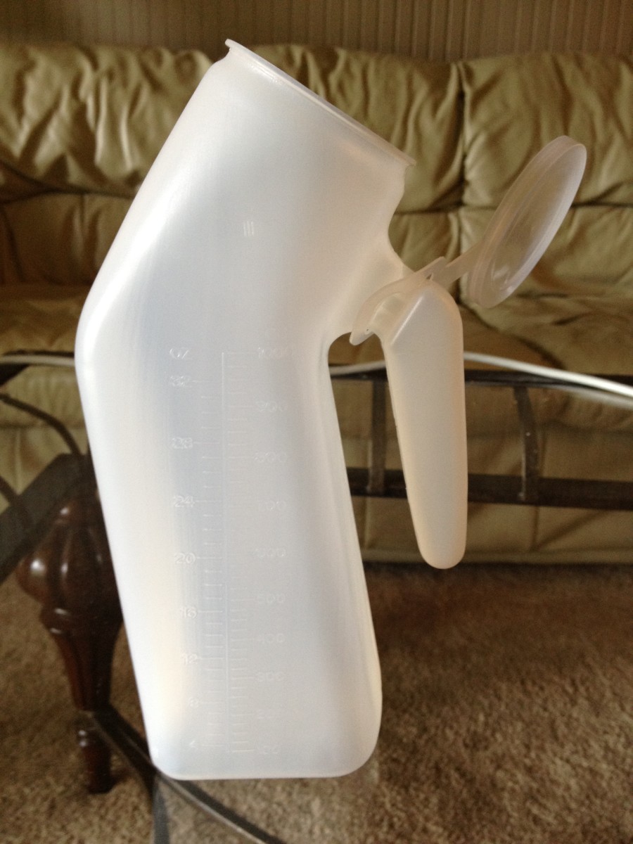 What I Learned About Total Hip Replacement, Avascular Necrosis, and