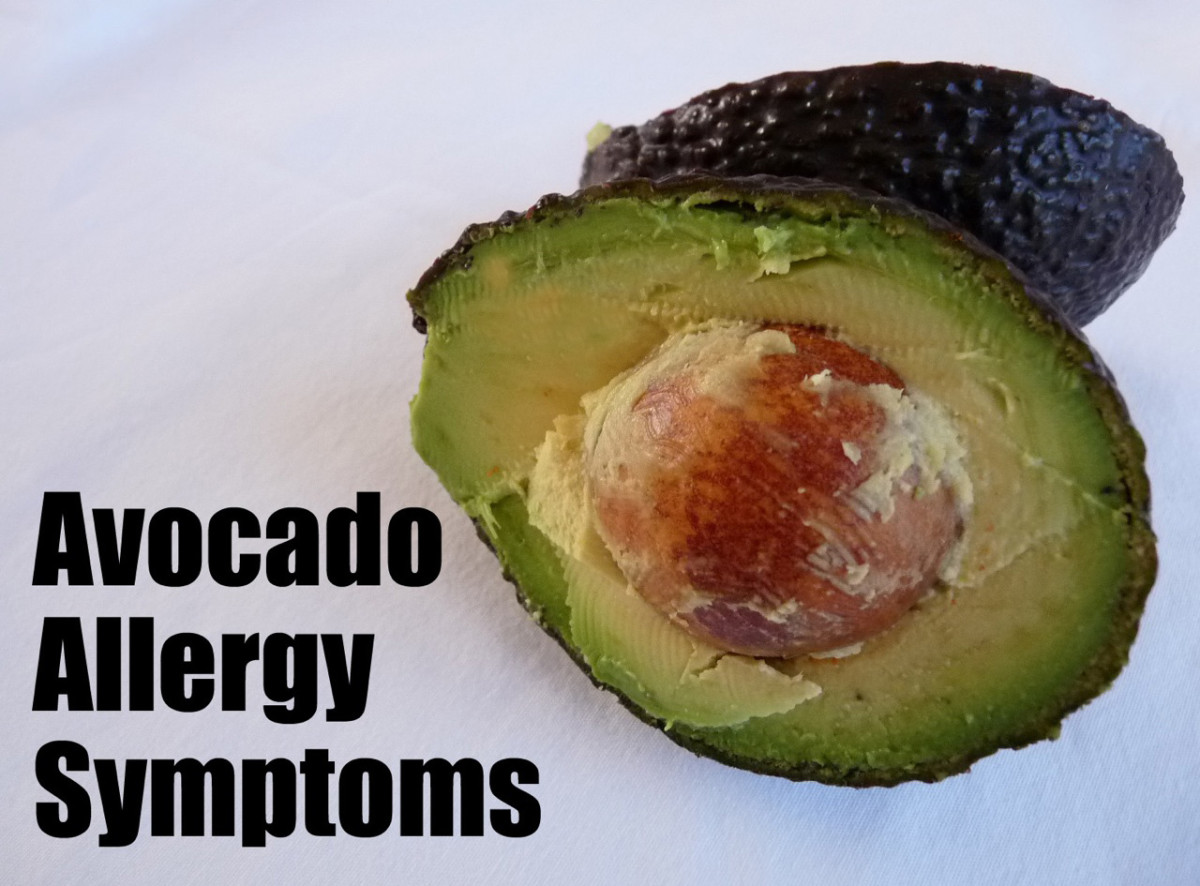 Carrageenan Allergy Symptoms HealDove