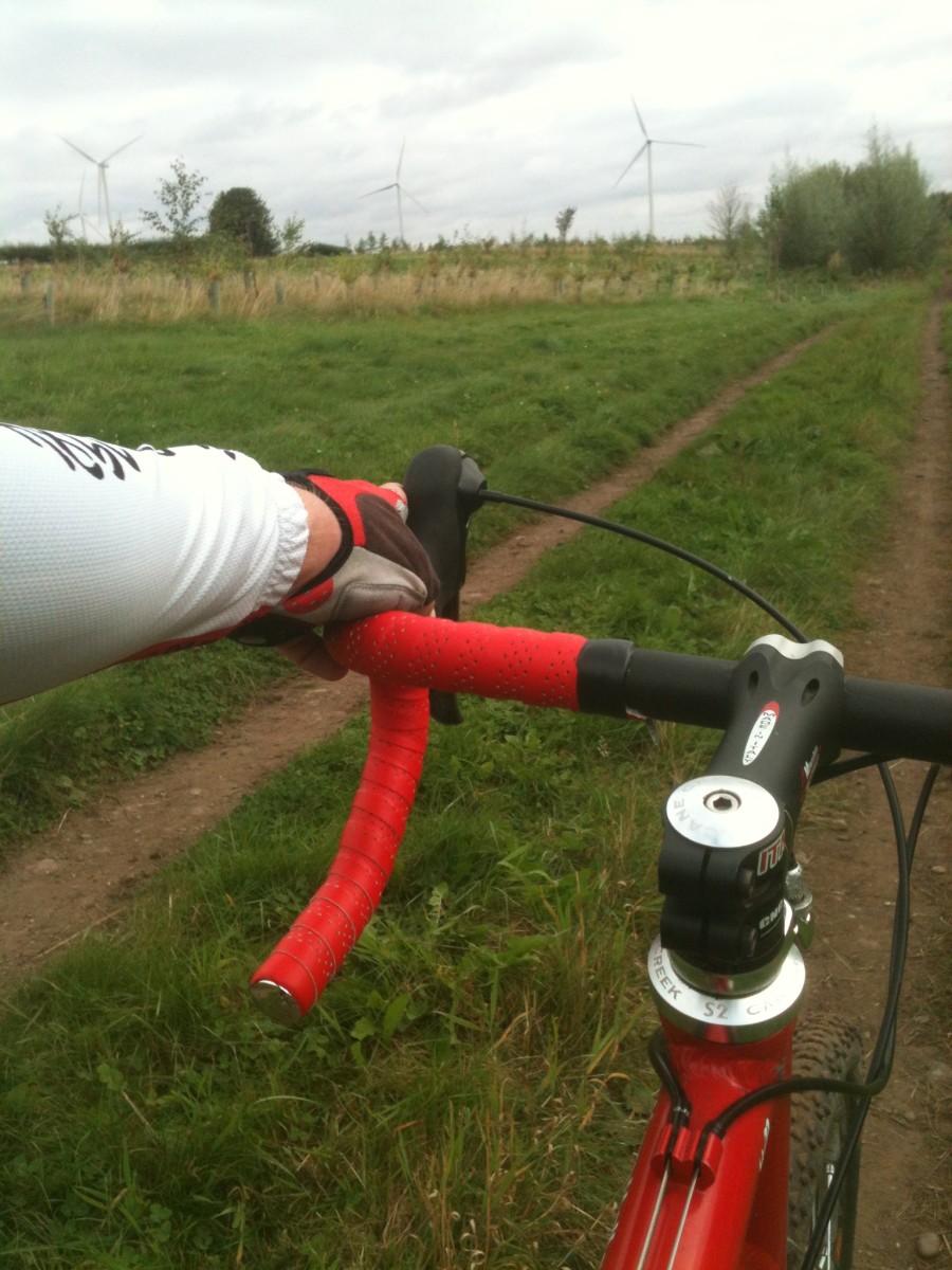 Wrist Problems From Cycling Causes, Symptoms, Treatment HubPages