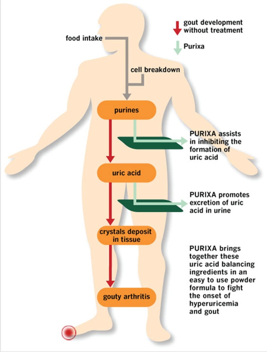 Gout and Uric Acid HubPages