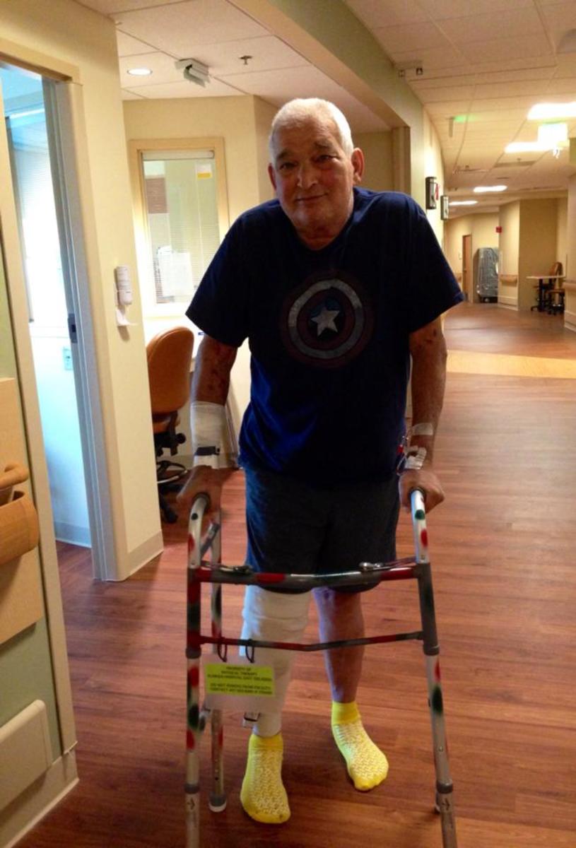 Tips for a Successful Total Knee Replacement Surgery hubpages