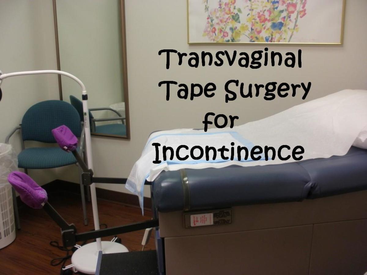 My Experience with TVT Transvaginal Tape Surgery for Incontinence HubPages