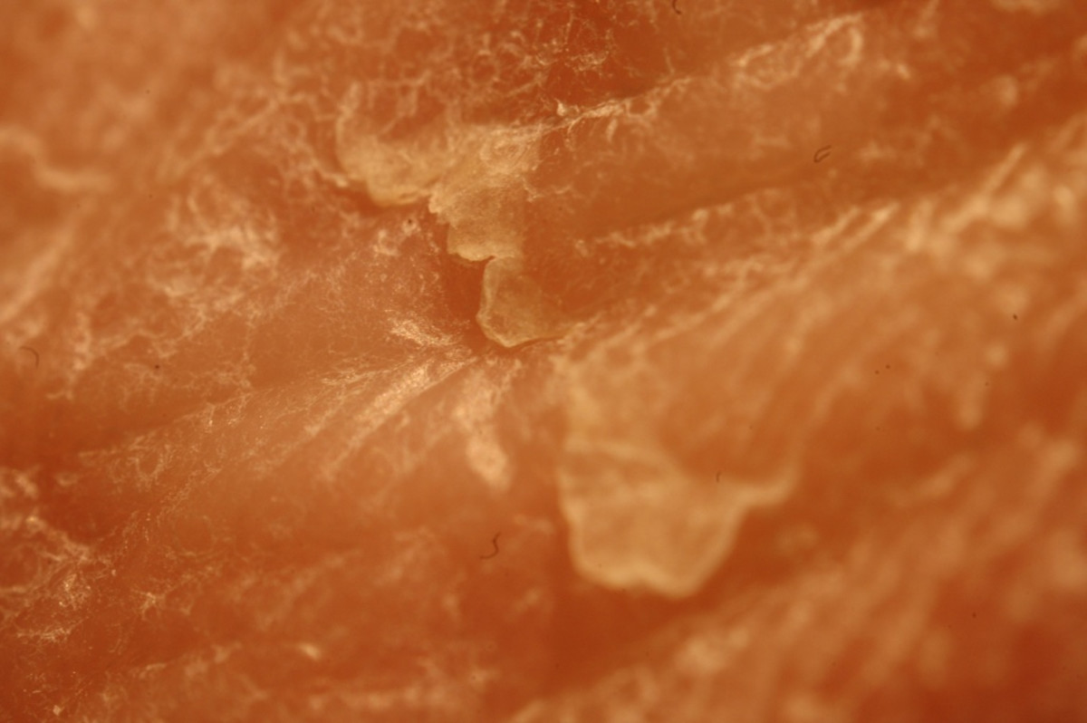 Treatment for Cracked, Bleeding Heels and Feet RemedyGrove