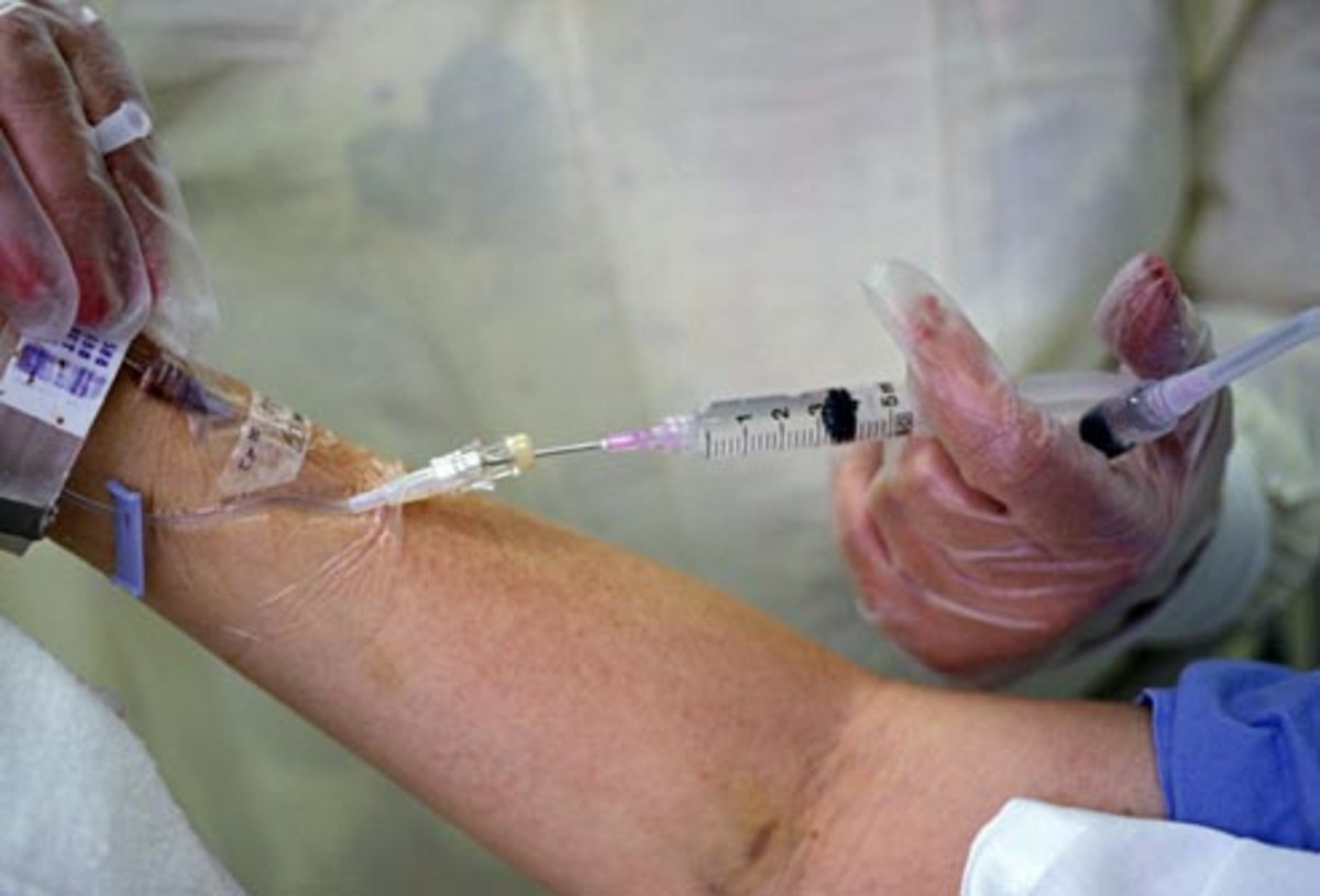 DVT What Is A Deep Vein Thrombosis? hubpages