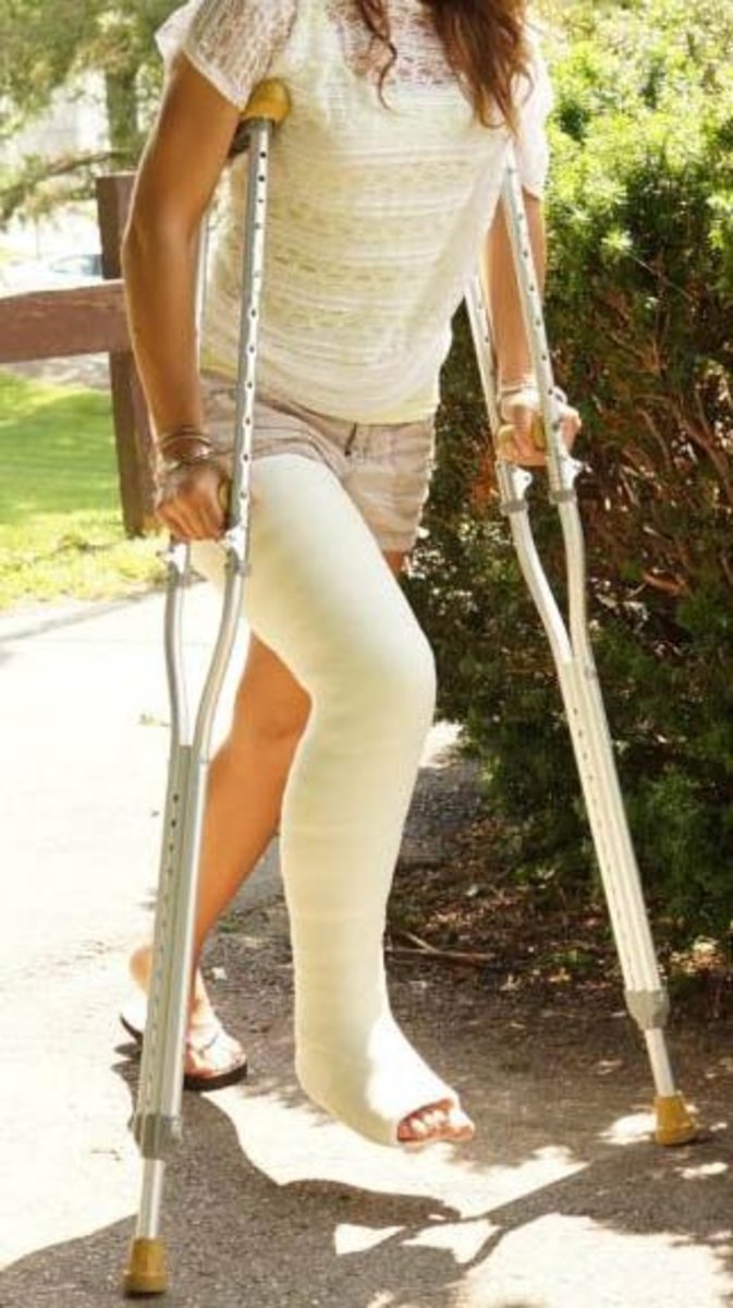 What It's Like to Wear a Cast HealDove