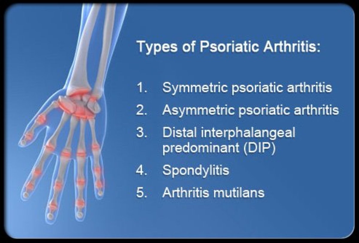 Symptoms, Causes, and Treatment of Psoriatic Arthritis HealthProAdvice