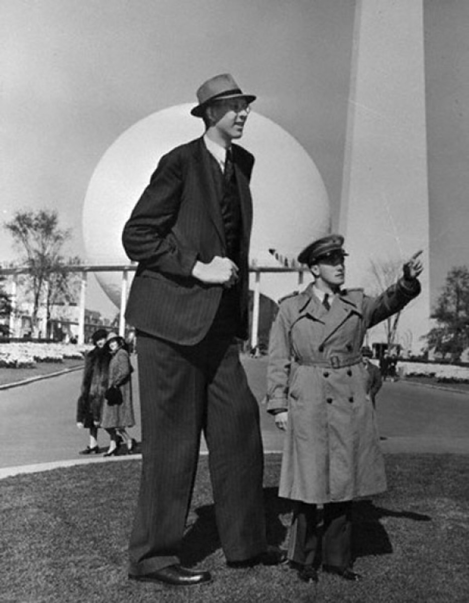 5 Real Giants, Biggest and Tallest Superhumans Ever & How Tall was