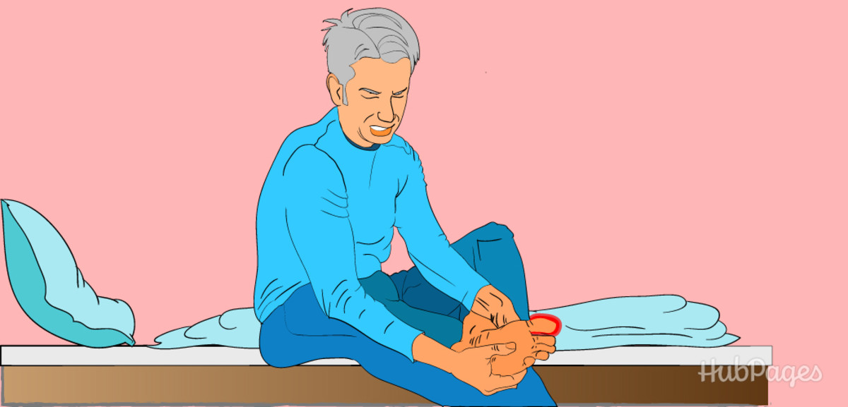 How to Instantly Relieve Pain from a Swollen Toe or Ingrown Toenail or