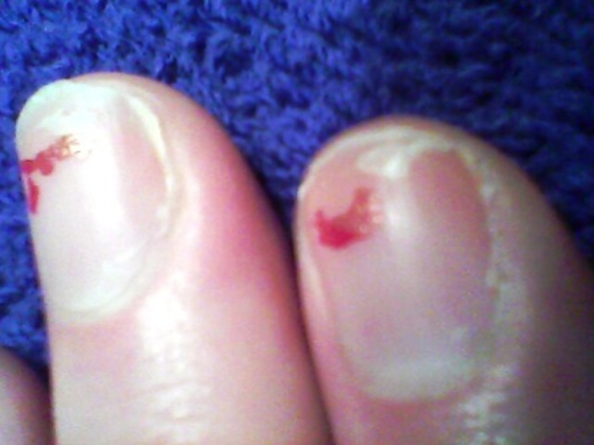 Nail Hardeners For Brittle Nails