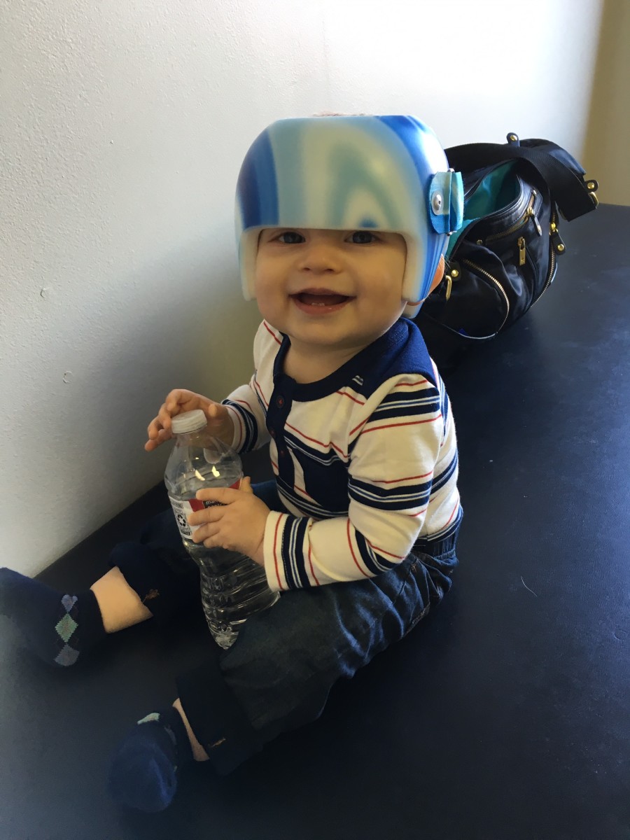 Helmet Therapy for Babies My Son's Story HealDove