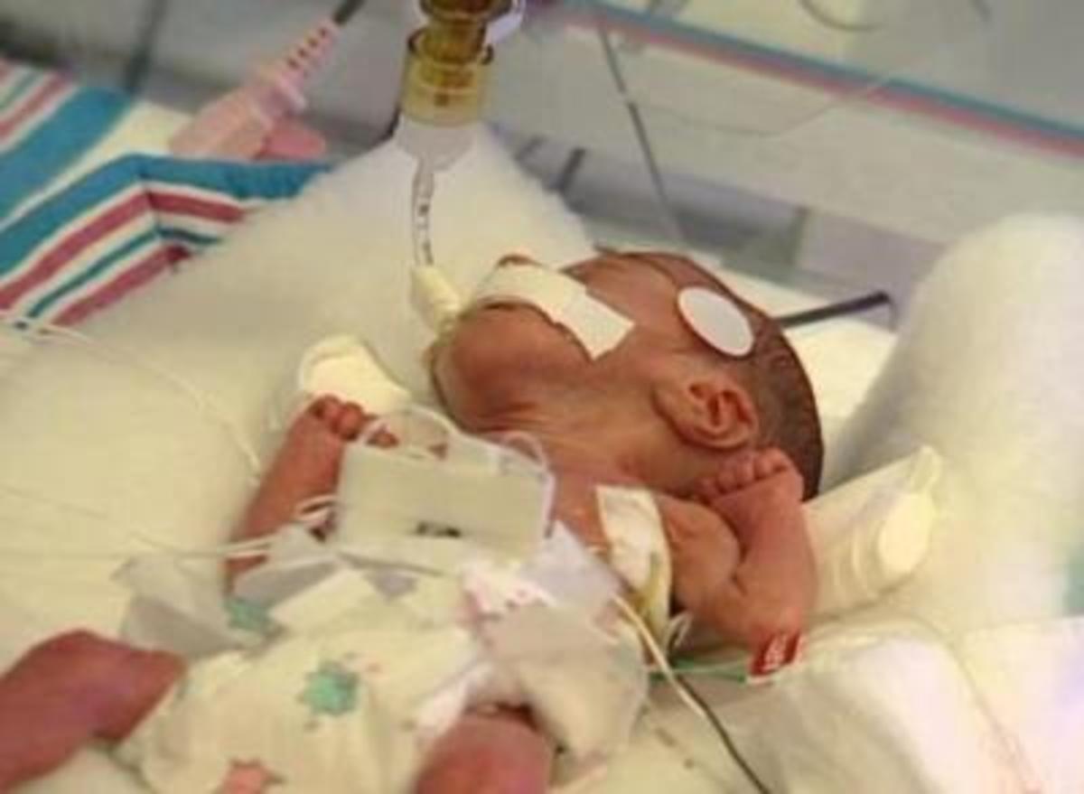 Ten Congenital Problems of the Fetus HubPages