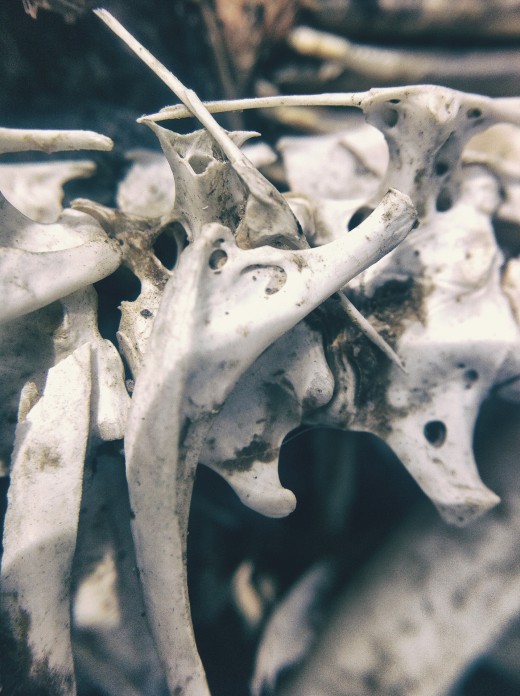 Turning Into A Human Statue Stone Man Syndrome hubpages