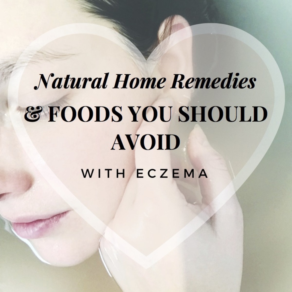 Natural Home Remedies and Foods You Should Avoid With Eczema RemedyGrove