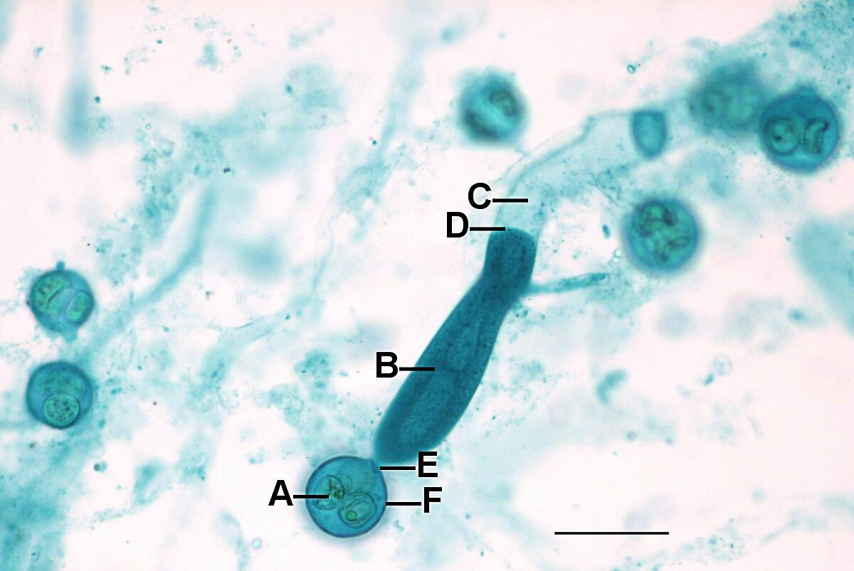 Saprolegnia and Phytophthora Facts Oomycetes or Water Molds Owlcation