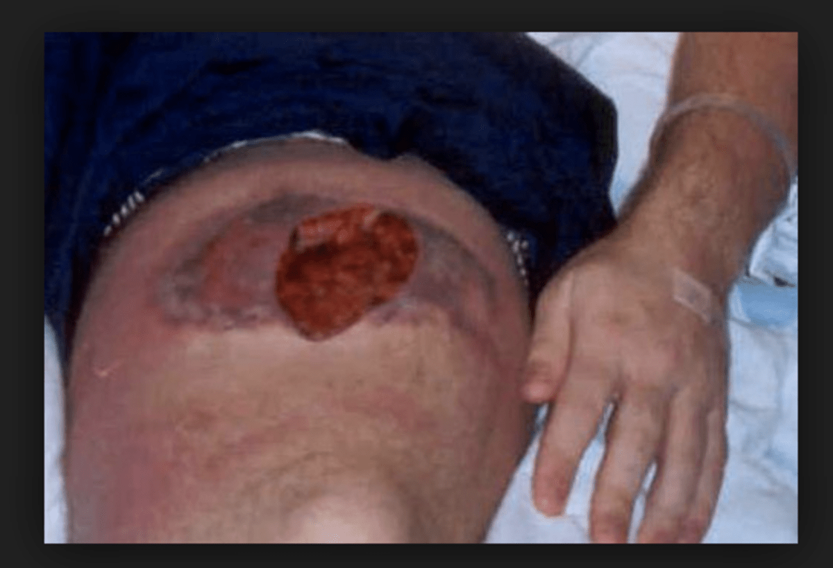 Brown Recluse Spider Control With a Sticky Trap Owlcation