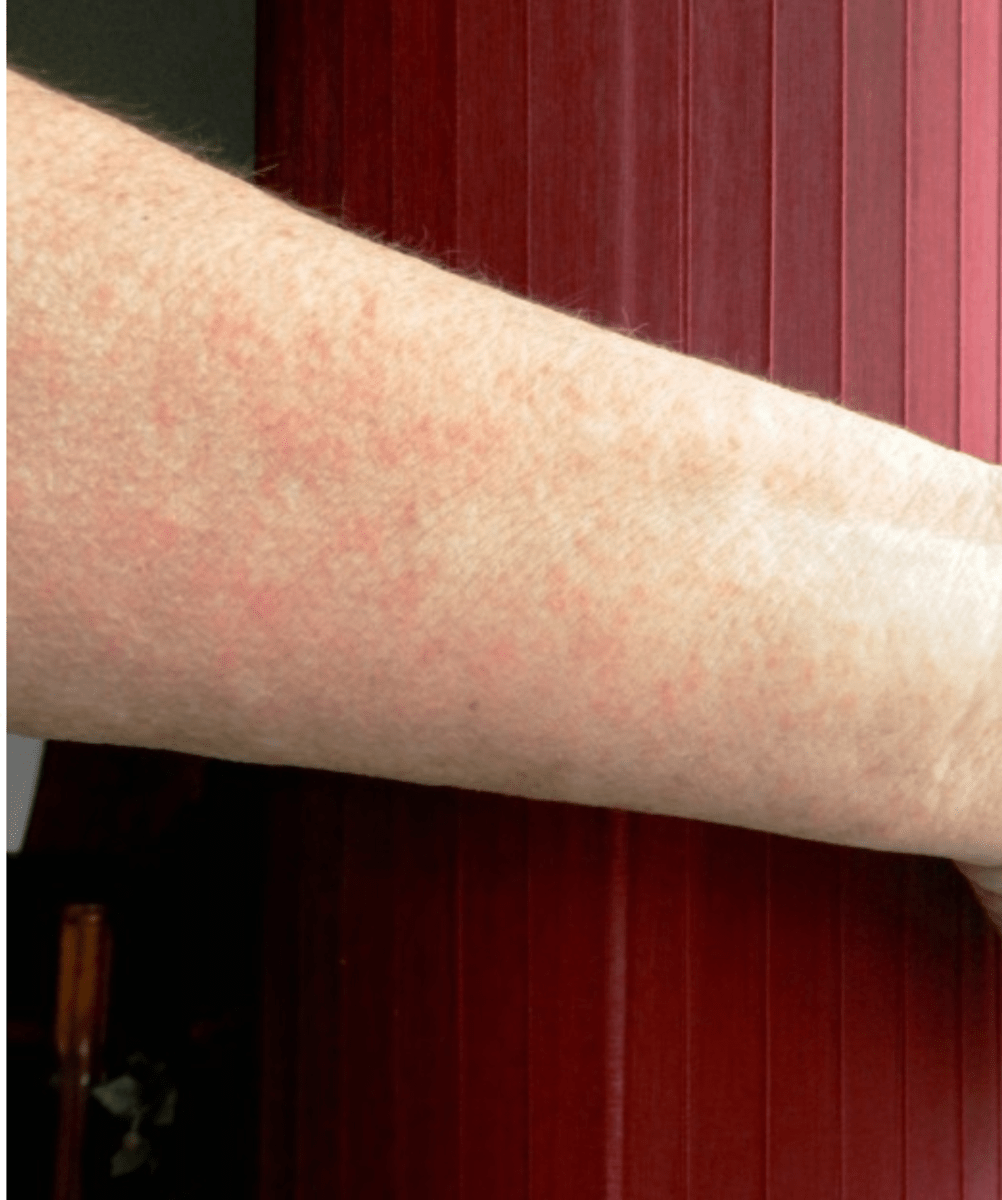 How to Care for Fire Sticks Succulents Dengarden