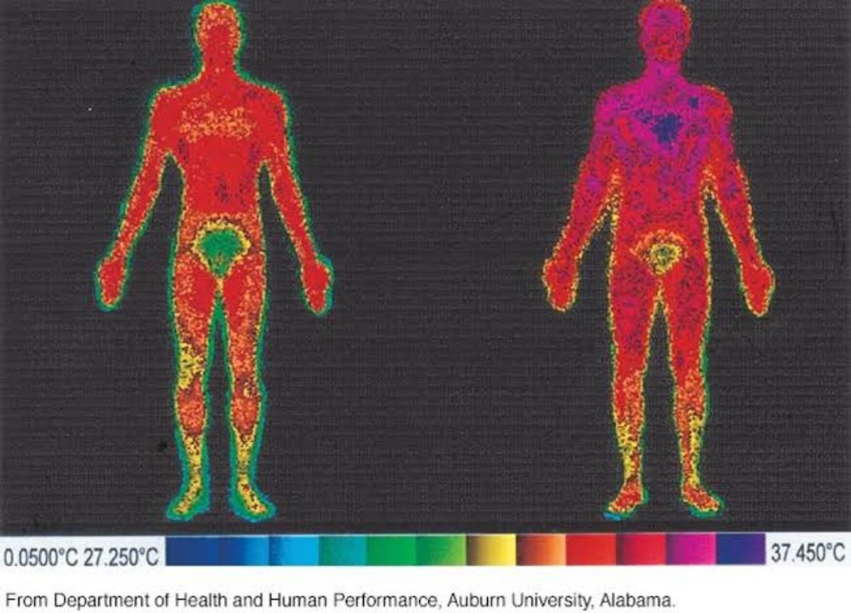 The Warmest and Coldest Place on the Body in Women and Men