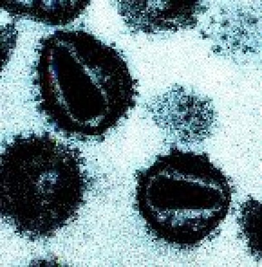 How Long Do Viruses Live on Surfaces? HubPages