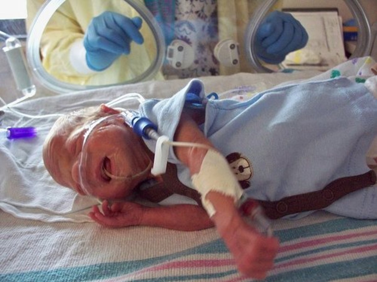 Interacting With Your Premature Infant Developmental Care in the NICU WeHaveKids