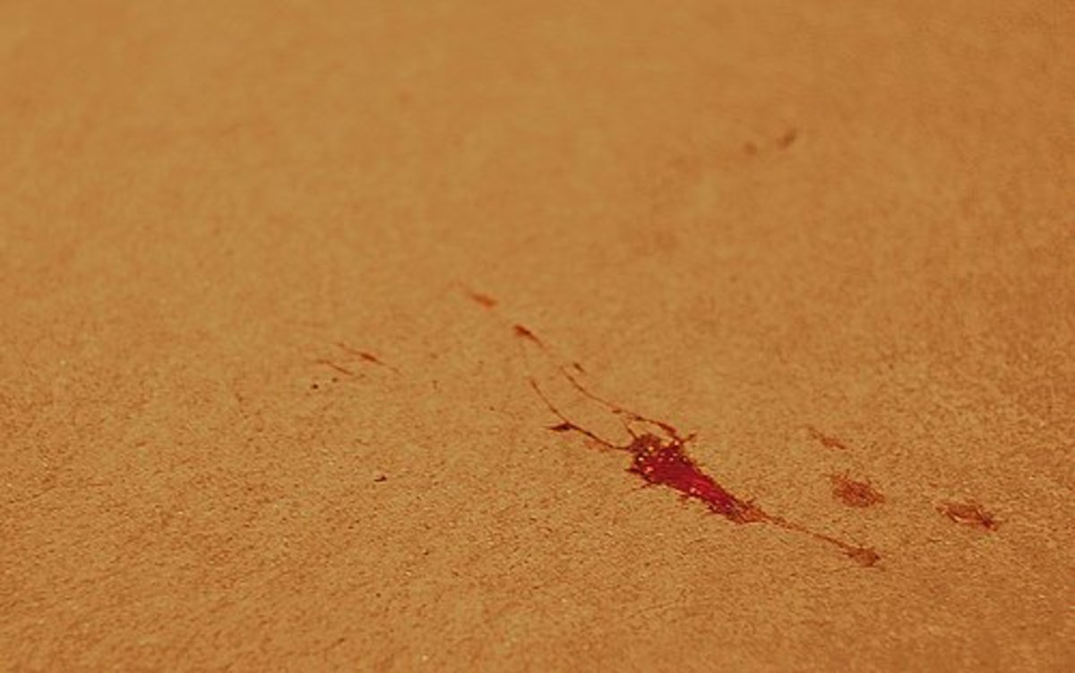 How to Remove Dry and Fresh Blood Stains Dengarden