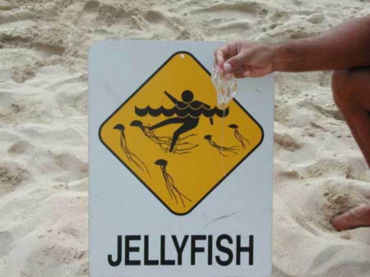 How to Treat Paiful Box Jellyfish Stings HubPages