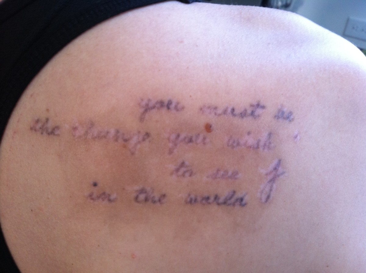 My Tattoo Removal Story TatRing