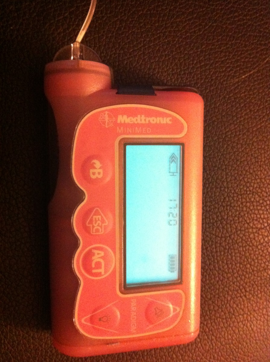 The Diabetic's Guide to Wearing an Insulin Pump HubPages