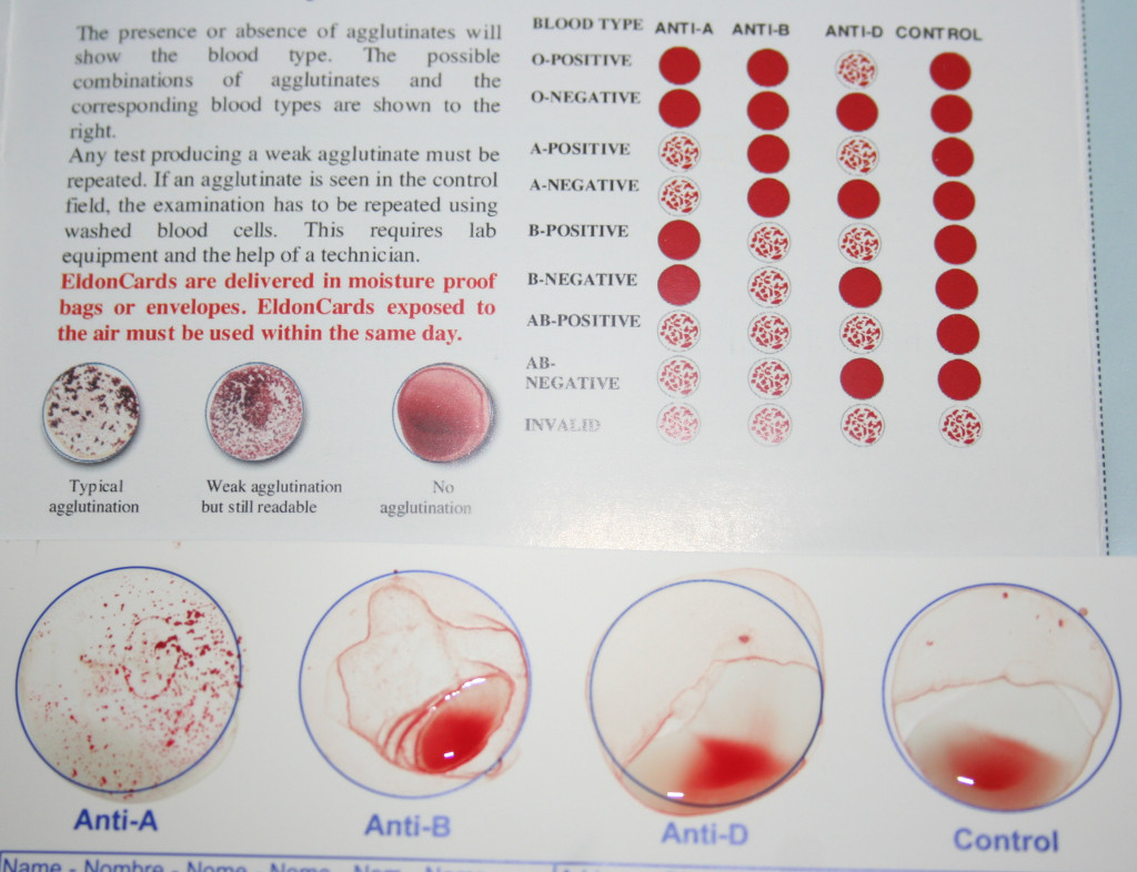 Natural Birth and the Rh Negative Mother hubpages