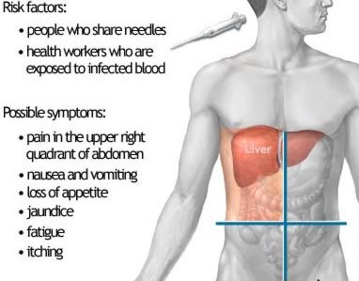 Autoimmune Hepatitis Causes Cirrhosis of the Liver HubPages