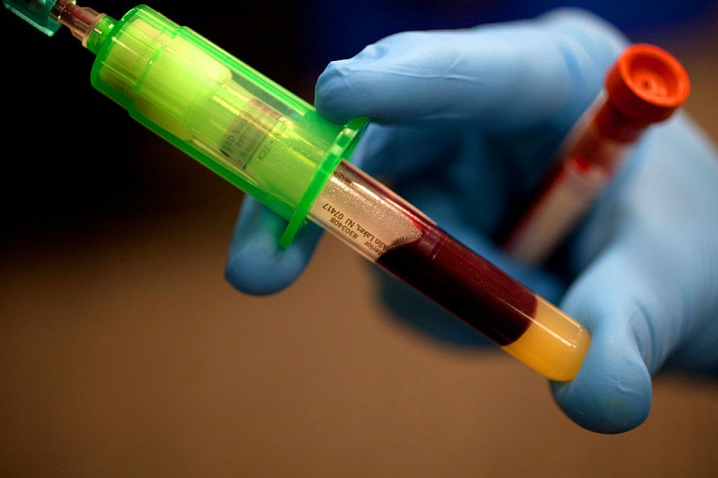 Understanding Your Blood Tests & Biochemistry Owlcation