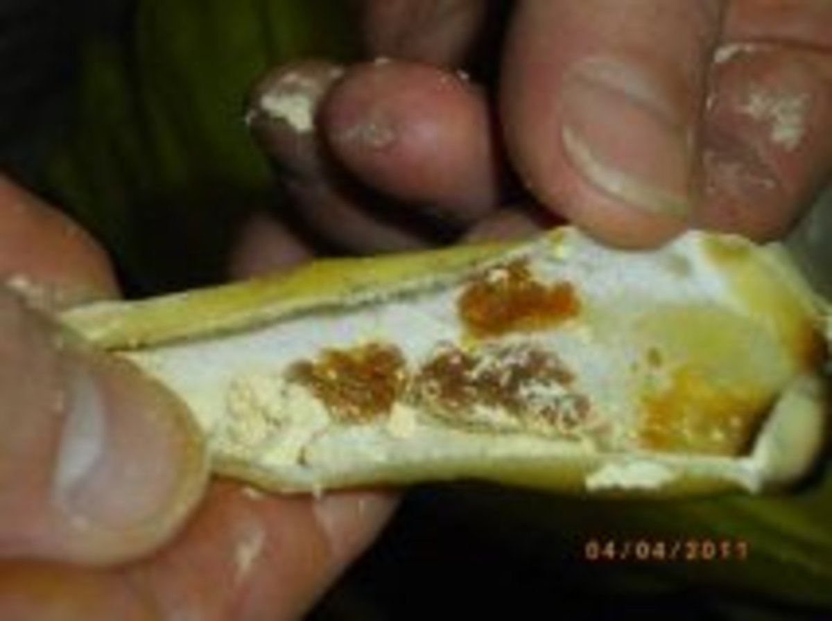 Tinnitus and Ménière's You can reduce noise and effects by using safe