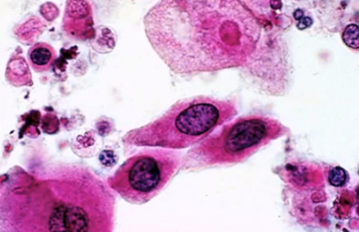 Cloudy Urine During Pregnancy Tips Mom Pregnancy