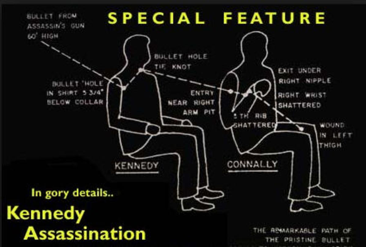 The Magic Bullet in the JFK Assassination