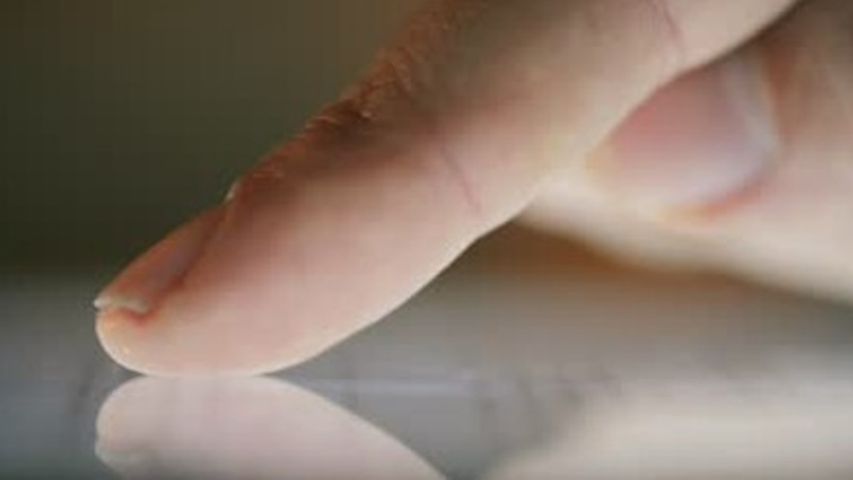 Dysesthesia Treatment, Symptoms, Types, Causes HubPages