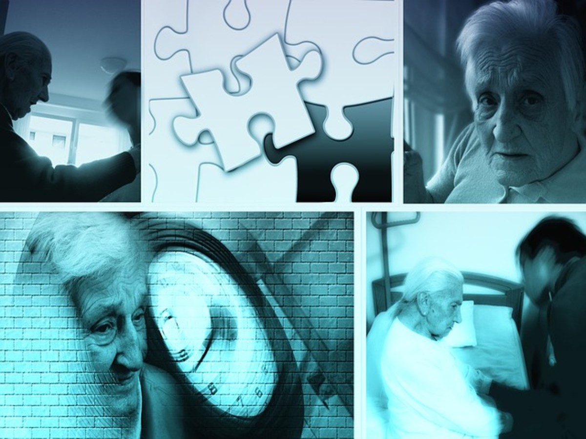 Quick and Easy Tests for Alzheimer's Disease HealDove