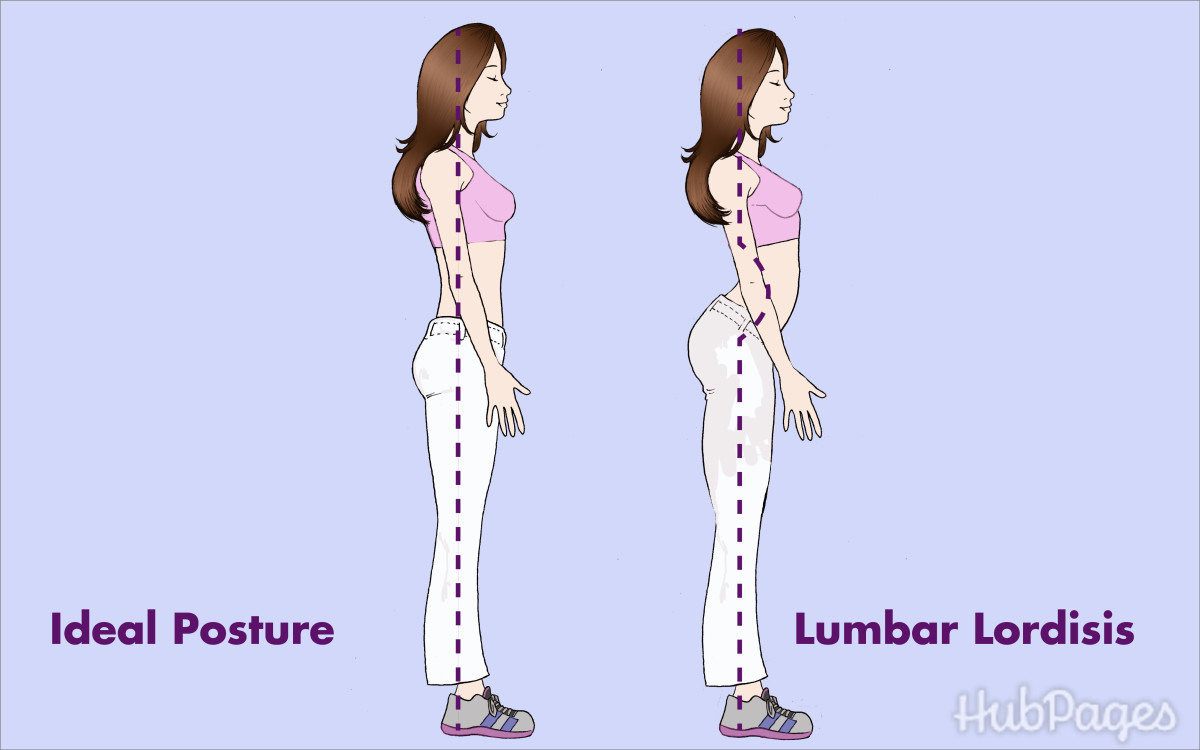 The Importance of Reversal of Cervical and Lumbar Lordosis YouMeMindBody