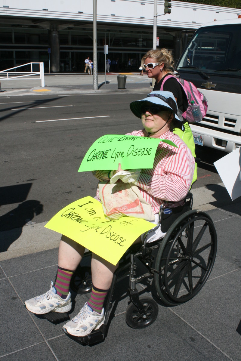 Consequences of Long Term Lyme Disease Infection HubPages