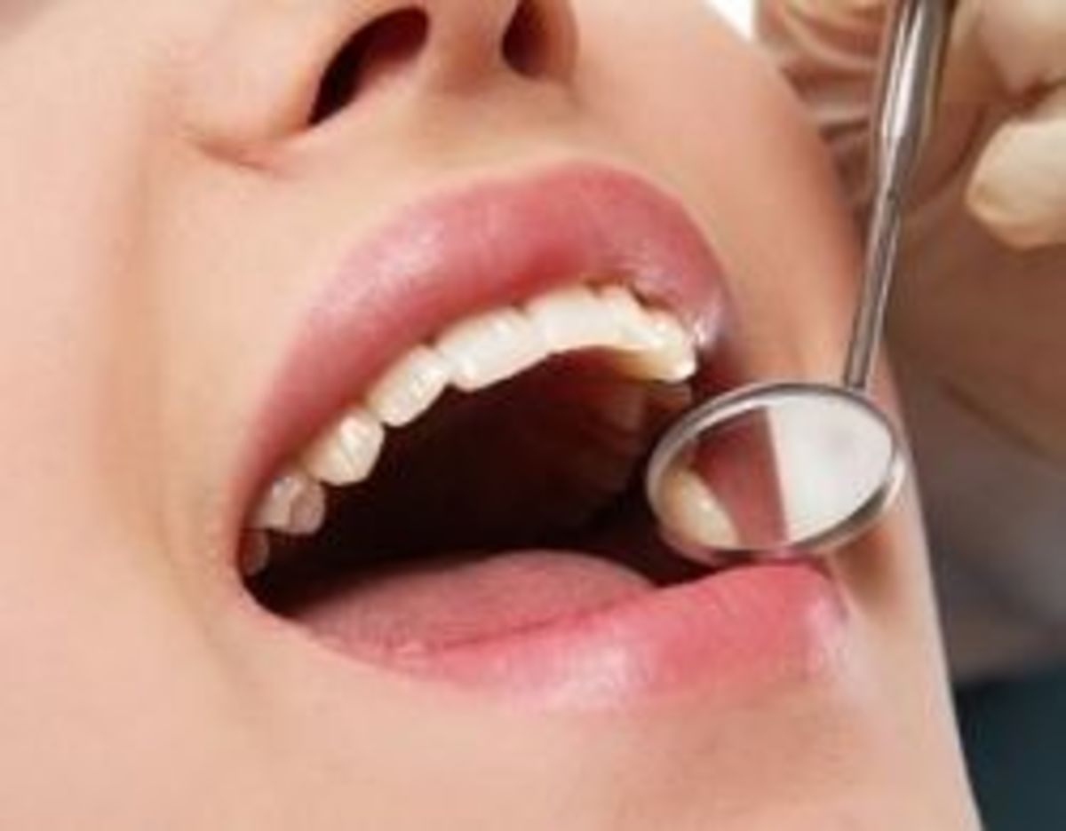 How to Remove Tartar from Teeth HubPages