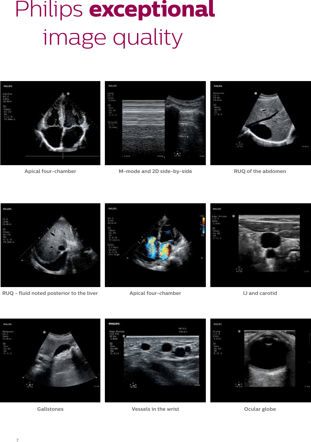 Philips 795090EM User Manual Sparq Product Brochure EM