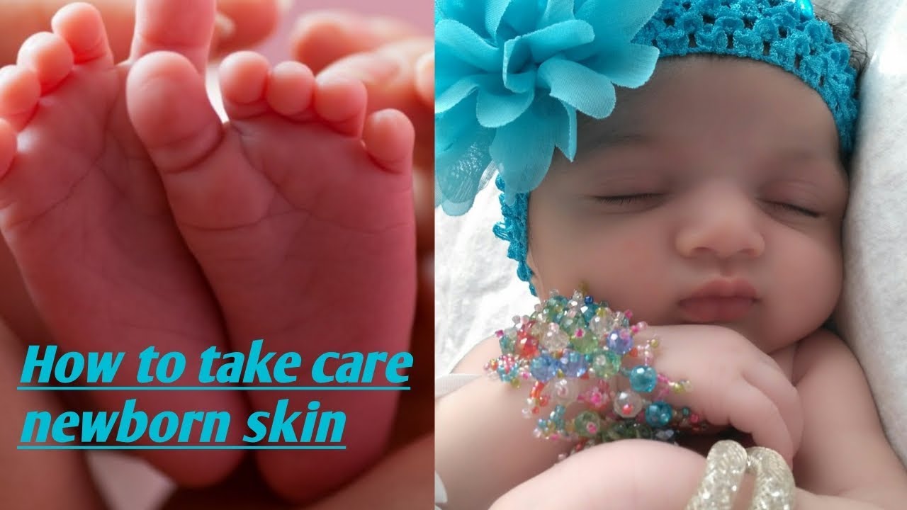 How To Reduce Newborn Baby's Dry Skin?/ Newborn Skin Care Tips(in English)