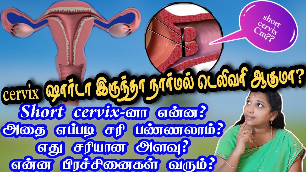 short cervix during pregnancy in tamil/cervix dilation/karupai vai