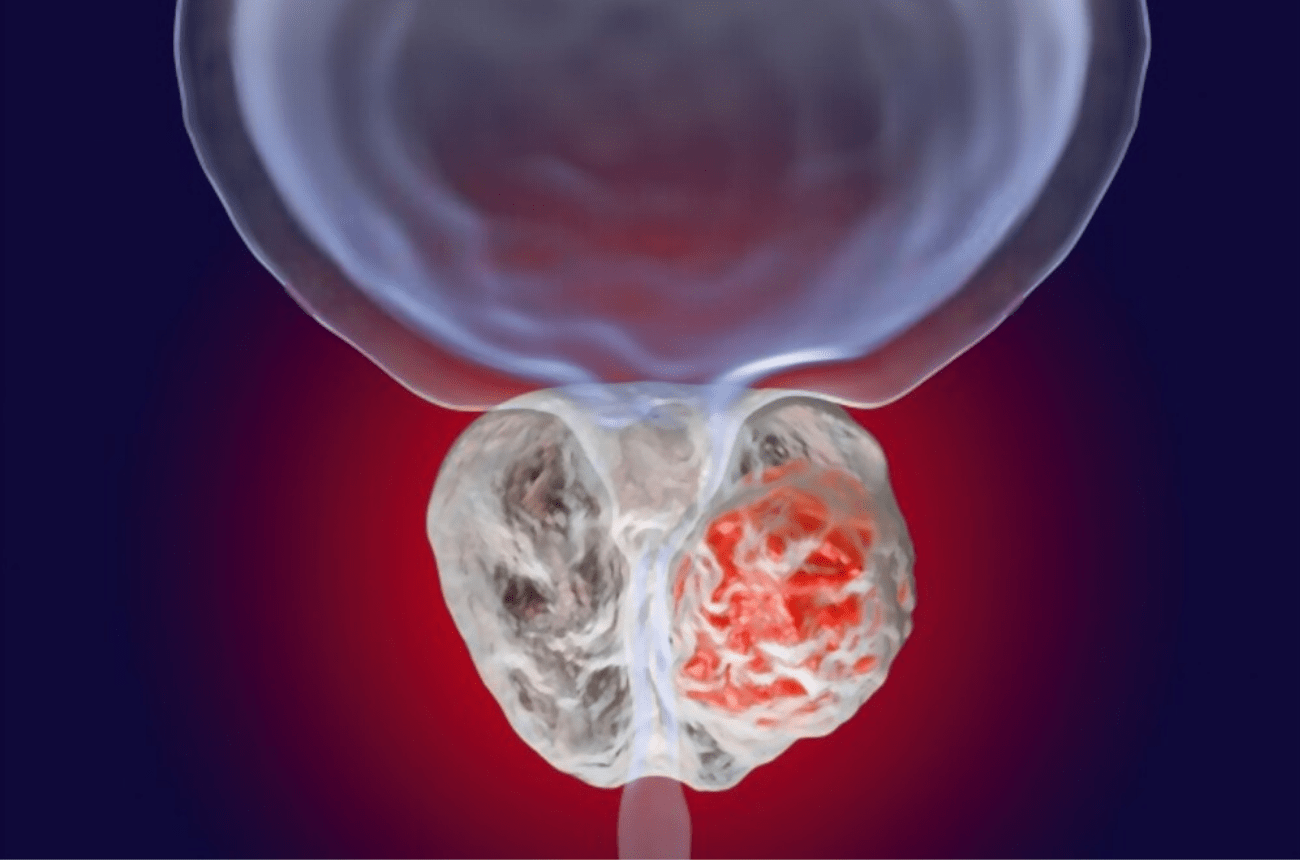 University Urology Associates of New Jersey New Jersey's Urology